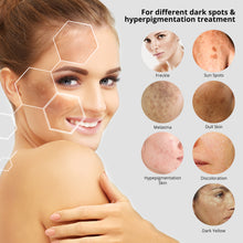 Load image into Gallery viewer, Dark Spot Remover for Face and Body, Dark Spot Corrector, Age Spots Cream and Freckle Remover- Formulated with Arbutin, Niacinamide &amp; Vitamin E-60 ml

