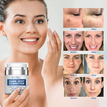 Load image into Gallery viewer, Dark Spot Remover for Face and Body, Dark Spot Corrector, Age Spots Cream and Freckle Remover- Formulated with Arbutin, Niacinamide &amp; Vitamin E-60 ml
